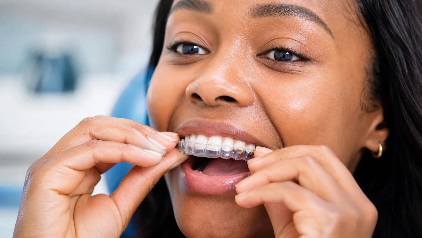 Clear Aligners
