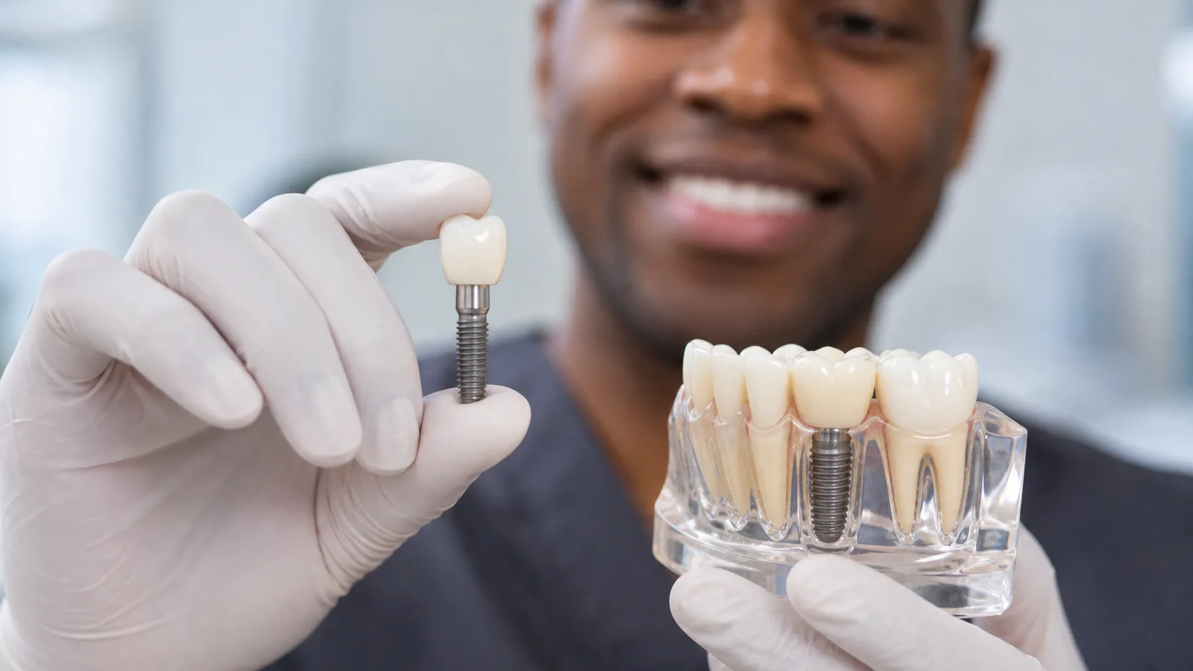 Dental Implants