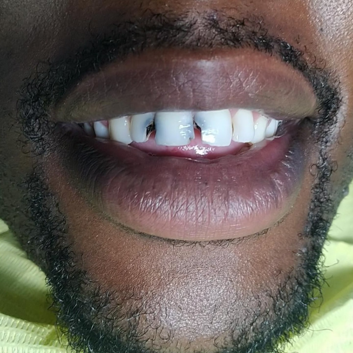 474602488_122132382674551992_4347088786290857244_n