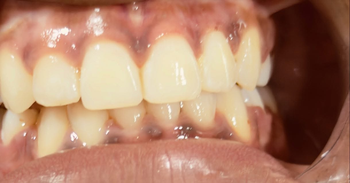 568668916_17896555500335281_3911813651527796839_n 568668916_17896555500335281_3911813651527796839_n